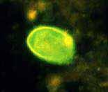 Membranes Can Remove Wide Range of Pathogens Virus Bacteria Protozoa T4 Phage E.