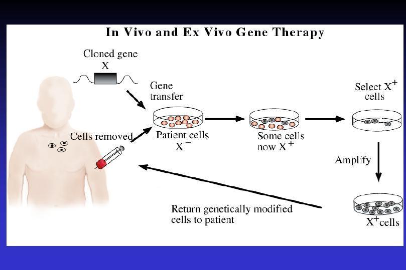 Gene therapy of ADA