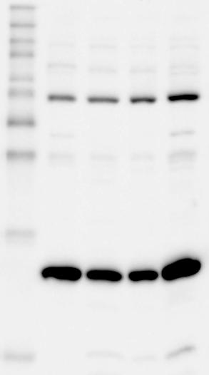 Western Blot Tri-Methyl-Histone H3 (Lys9) (D4W1U) Rabbit mab Other Company s ENCODE Approved Tri-Methyl-Histone H3 (Lys9) Antibody 2 14 1 8 6 5 4 3 2 1 HeLa C2C12 C6 COS Tri-Methyl-Histone H3 (Lys9)