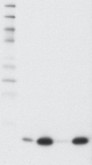 Western Blot Acetyl-Histone H3 (Lys9) (C5B11) Rabbit mab Other Company s ENCODE Approved Acetyl-Histone H3 (Lys9) Antibody 2 14 1 8 6 5 4 3 3T3 HeLa 2 14 1 8 6 5 4 3 3T3 HeLa The Acetyl-Histone H3