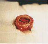 Application of PHAs Surgical Applications: Implants Ongoing PROJECT BRIC [Laura Bassi Center of