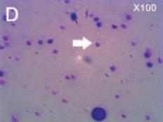 Tropocells PRP 2ml Platelets concentration fold RBC (10 6 /ul) WBC (10 3 /ul Granulocytes % Mononuclear