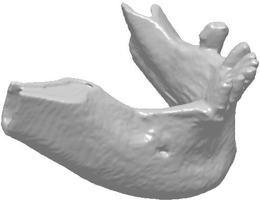 3D model donje vilice (žuta boja) preklopljen preko modela zuba i kosti vilice Nakon što se generiše 3D model donje vilice, on se izvozi u neki od formata zapisa koje pruža program 3D DOCTOR.