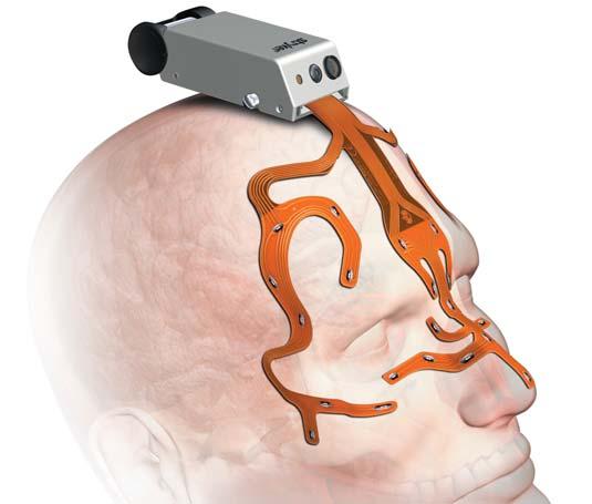 Craniomaxillofacial Navigation Endoscopy Neuro Spine ENT DuraMatrix Onlay DuraMatrix Onlay is a conformable and resorbable membrane matrix.