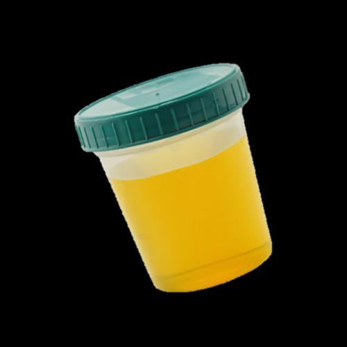 1.Introduction Urine: Almost sterile 1.5L/(cap d) 1.
