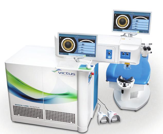 The Third-Generation Victus Femtosecond Laser BY PAVEL STODULKA, MD, PhD Nearly 3 years ago, Gemini Eye Clinic became the first center in Europe to use the Victus femtosecond laser platform (Bausch +