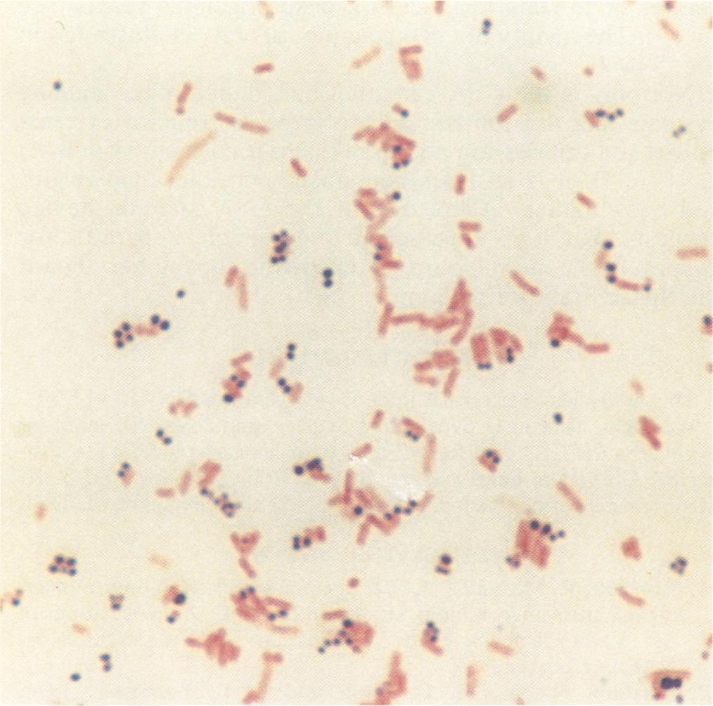 - i t a. VOL., MICROGRAVITY-COMPATIBLE GRAM STAINING APPARATUS f U i r: t.* FIG.. Gram stain of gram-positive cocci and gram-negative rods, using the GSA.