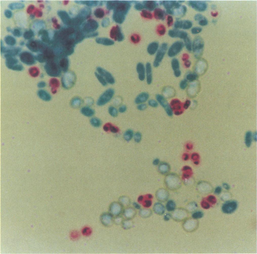 Each pair of slides, GSA and conventional, from each of the six sources was analyzed for the different types of cells on the slide.