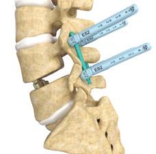 2B #2 23% Stryker offers products for the specific needs of Neurosurgical, Spine and ENT physicians with a comprehensive suite of products developed for the fine tolerances required by these