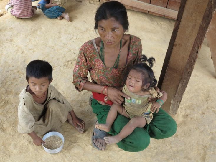 Almost 50% under five children malnourished Under