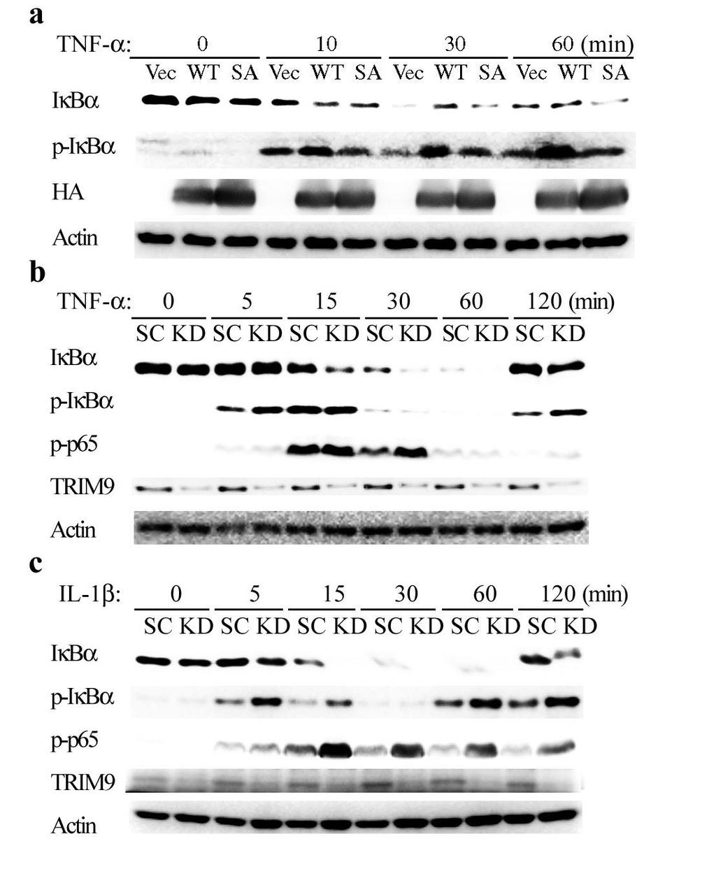 Supplementary Figure 6. TRIM9 suppresses I B degradation and p65 phosphorylation.