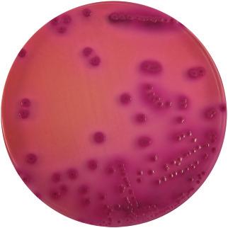 Analysis chart Industries and related bacteria Yersinia Vibrio Streptococcus thermophilus Sterility