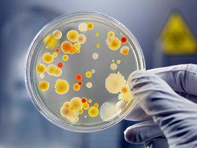 Markers of bacteria Visible markers wild and mutant growth is different: colony size,