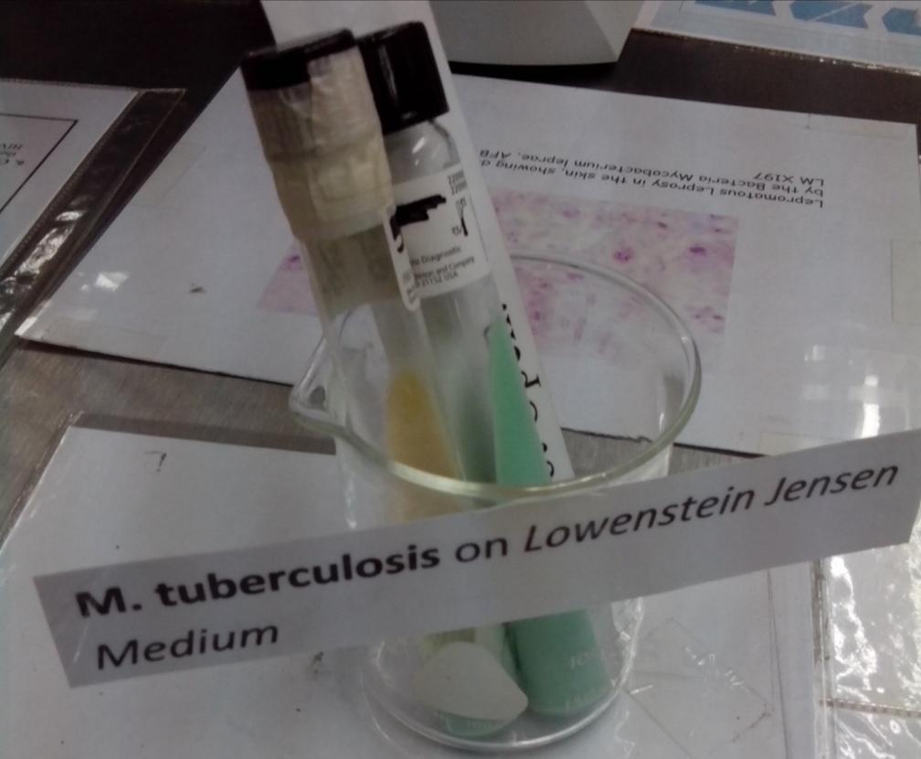mycobacterium LOWENSTEIN
