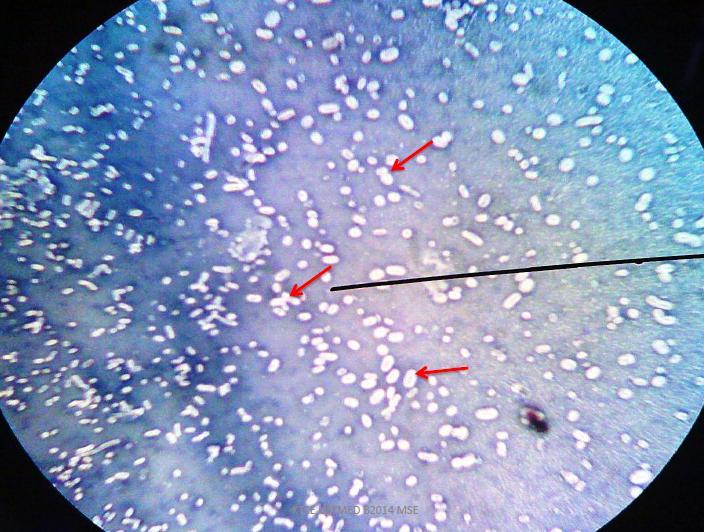 For Klebsiella pneumoniae, etc. INDIRECT METHOD (Congo Red): Also called negative or relief stain 1. Using a sterile inoculating loop, fish out a small colony of K.