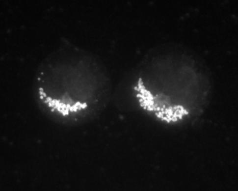 iii. Microscopy: A. B. Figure 3. Fluroescence microscopy of TMRE labeled mitochondria in live cells.