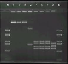 The bright bands on this gel are DNA fragments produced by restriction enzyme digestion. The bands to the far sides are DNA size markers.