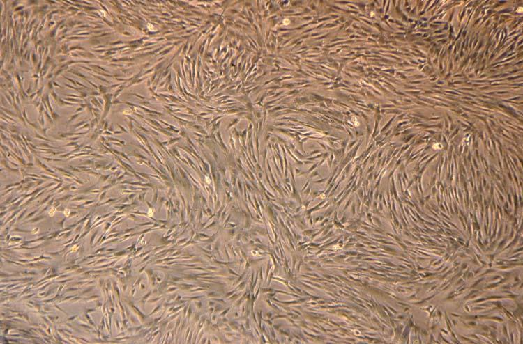 Mesenchymal Stromal Cells Large-scale Culture
