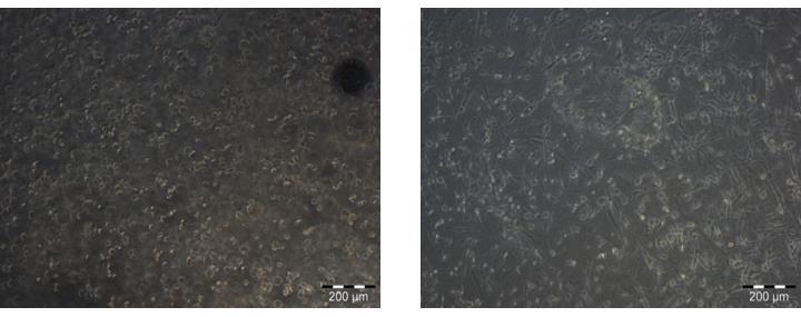Cells Encapsulated in Puramatrix TM Cells encapsulated in PuraMatrix hydrogel; Phase contrast images showing the morphology and cell