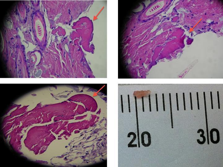 Histology Histological slides at 400x. A) Bone tissue formation at 4 weeks.