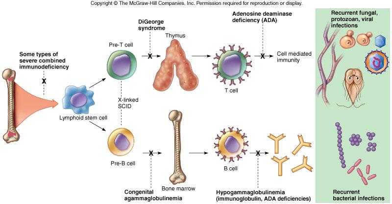Immunodeficiency A person can be born with or develop a weakened immune system Primary Secondary Primary Antibody