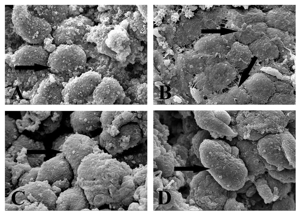 Results: ESI1. NG restored IR-induced hepatic ultrastructural alteration: To understand IR-induced ultrastructural changes in murine liver, scanning electron microscopy (SEM) was carried out.