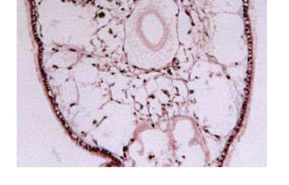 mansoni infection (20 miracidium/snail), showing a focal cellular reaction (arrow) with a granuloma-like appearance (200x).