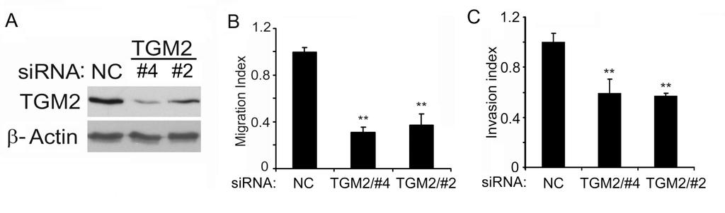 Li et al., Supplemental Figures Fig. S1. Suppressing TGM2 expression with TGM2 sirnas inhibits migration and invasion in A549-TR cells.