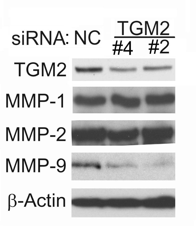 Fig. S3. Restoration of TGM2 expression alleviates TGM2 sirna s inhibition on migration in A549-TR cells. A, A549-TR cells were stably transfected with TGM2-expressing or an empty vector.