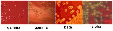 This media is differential because: Certain bacteria produce enzymes (hemolysins ) that act on the red cells to produce either: Beta hemolysis: Enzymes lyse the blood cells
