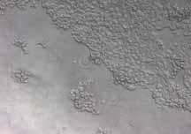 Beside an improved adhesion and proliferation of primary cells and various cell lines, CELLCOAT plates are highly suitable for serumfree and serumuced cell cultivation and experiments which include