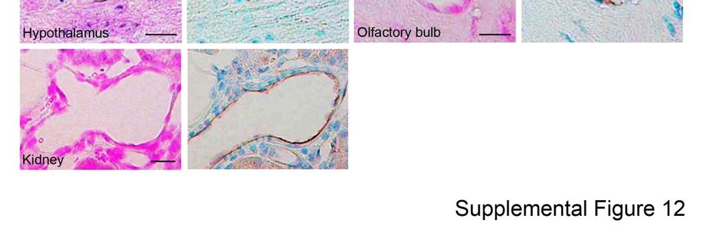 olfactory bulb and kidney (Spns2: purple).