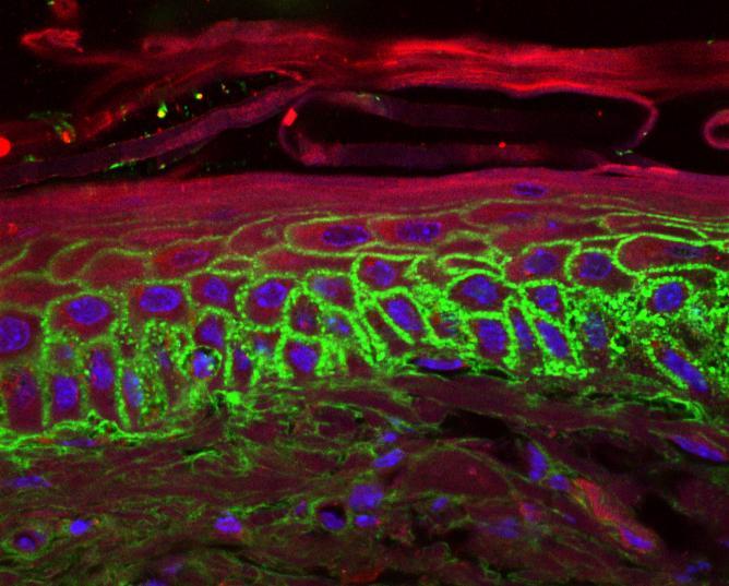 Immunofluorescence staining of tissue (skin section) Why mounting? - Cover slips hold samples in place - Protects sample from inadvertent movement and contamination.