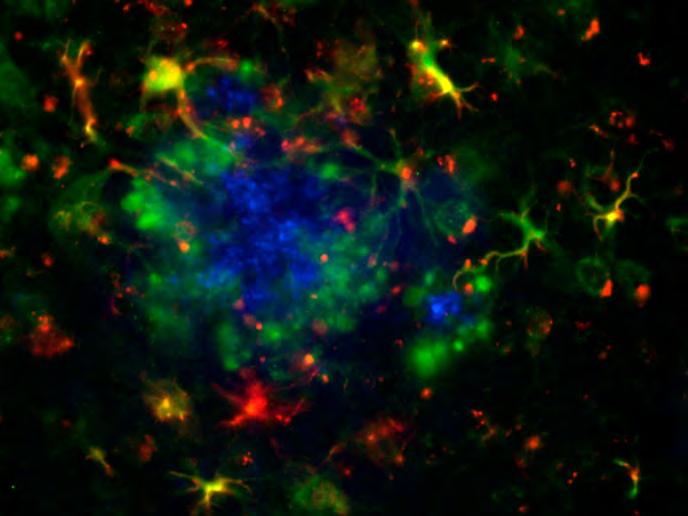 General and Social Psychiatry Fig. 1: This picture shows a plaque in an Alzheimer mouse. The plaque (blue) is surrounded by reactive astrocytes (red), most of them express a calcium channel (yellow).