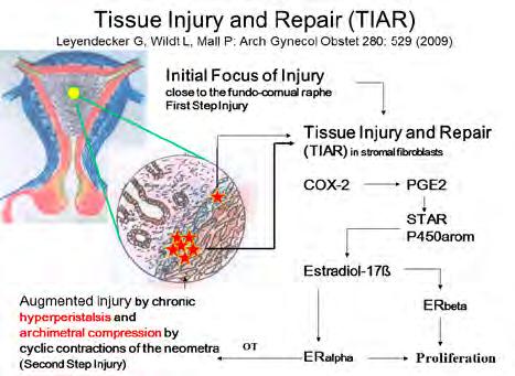 2: TIAR-Tissue injury and Repair Archived Gynecolgy and Obstertics novel prostaglandin antagonists on pain in patients suffering from endometriosis.