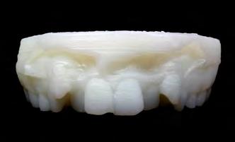 Research 3-D Low Budget Printer The aim of the study was to evaluate the benefits and drawbacks of 3D dental mo - d el printing compared to standard dental plaster casts.