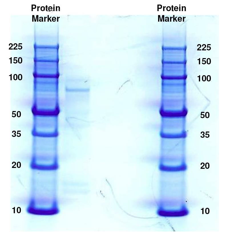Advantages of HPCE Traditional I-Dimensional Polyacrylamide gel electrophoresis 1D gels are 1950 s Technology.