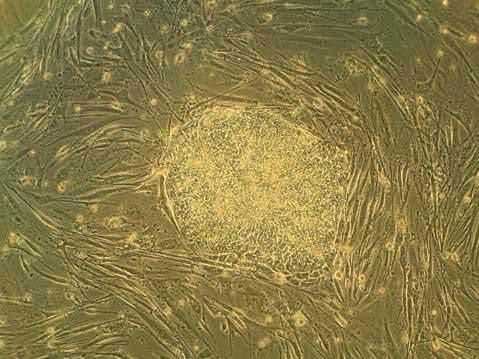 Human embryonic stem cells Obtained in 1998 by J.