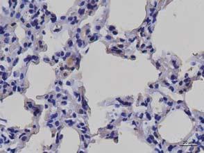 of CXCL5 in the lung tissue of