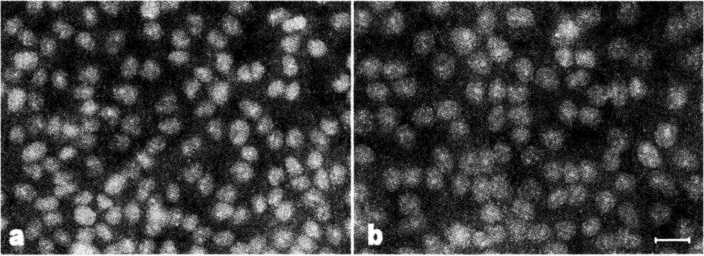 Fig 2. Untreated (Control) human Lep 3 cells (A) and cells cultured for 72 h in a Sr-modified dicalcium phosphate medium (B) ity and microporosity (3, 4, 5, 12).
