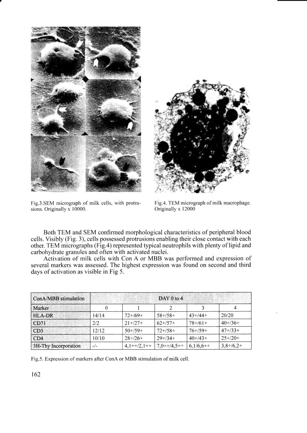 Fig.3.SEM micrograph of milk cells, with protru- Fig.4. TEM micrograph of milk macrophage, sions. Originally x 10000.