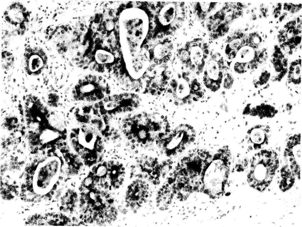 mucous neck cells of antrum. MUC6 was localized in the glands o f the antrum and in some mucus neck cells.