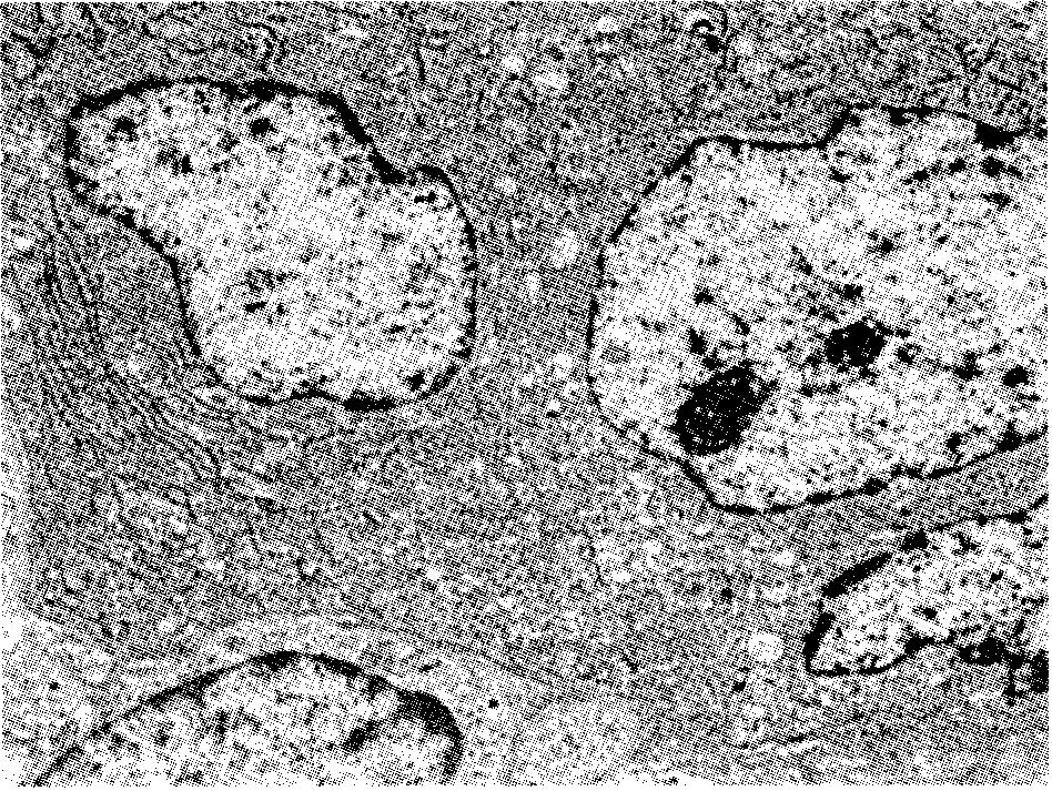 Finally, they were mounted, covered, contrasted and examined with an electron microscope Hitachi 500. Results Our study revealed different cell types: Multinucleated, osteoclast-like giant cells: Fig.
