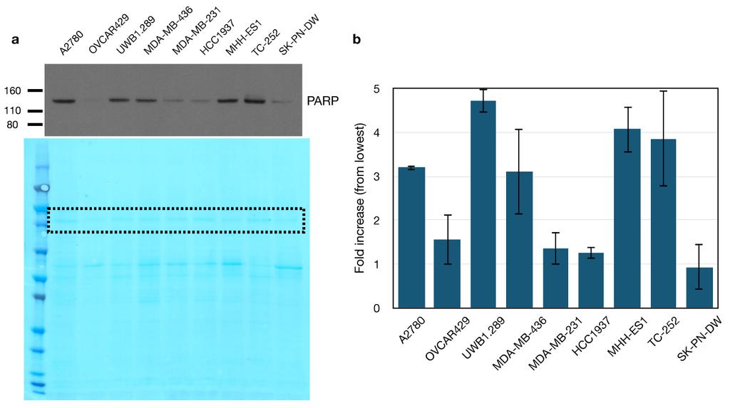 Figure S2. PARP1 protein expression in a panel of breast, ovarian, and Ewing s sarcoma cell lines. Cells were grown to confluence, lysed, and equal total protein was loaded and run on SDS-PAGE.