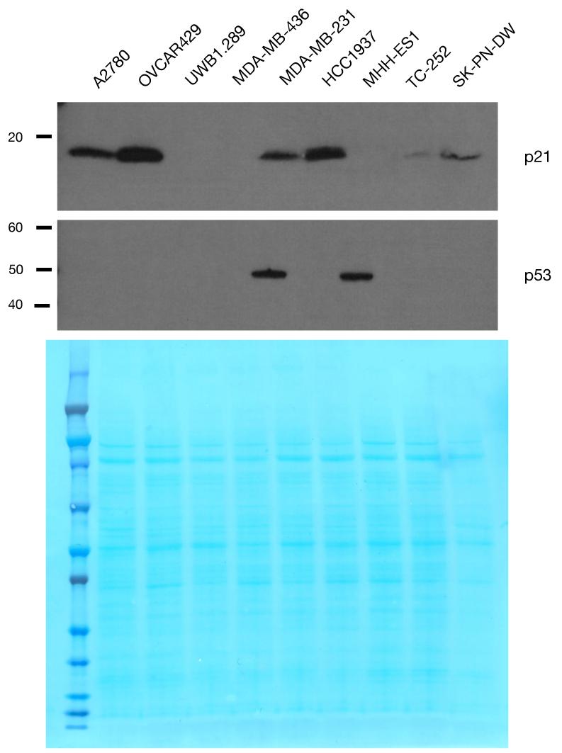 Figure S5. p21 and p53 protein expression in a panel of ovarian (left three lanes), breast (middle three lanes), and Ewing s sarcoma (right three lanes) cell lines.