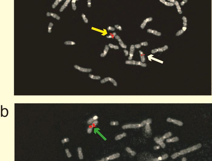 a, This cell has a short chromosome 13 (yellow arrow) and a normal-looking chromosome 13 (white arrow), both