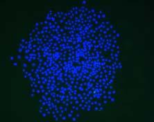 Figure 1: A, Immunofluorescence staining of clonogenic survival assays using the PCC and PSC specific markers cytokeratin 8