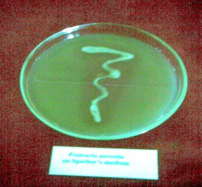 Potash mobiliziing Bacterium c Potash mobilizing bacteria To study the response of mulberry to co-inoculation with potash mobilizing, nitrogen fixing, phosphate solubilizing and