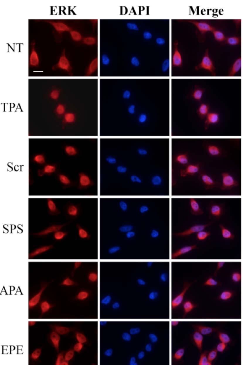 Supplementary Figure 2. Optimization of the nuclear-translocation-inhibiting peptide. HeLa cells were grown in 0.