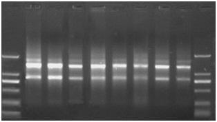 VIII. Experimental Examples 1. Purification of total RNA from cultured cells 10 μg total RNA can be obtained from 1.0 x 10 6 HL 60 cells using the kit (Fig. 1).